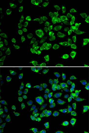 a09882 psmd13 primary antiboties if testing 2