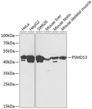 a09882 psmd13 primary antiboties wb testing 1