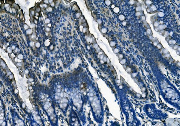 a09887 1 pi16 primary antibodies ihc testing 3