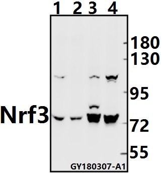 Western blot (WB) analysis of Nrf3 (D530) pAb at 1:500 dilution
Lane1:CT26 whole cell lysate(40ug)
Lane2:The Uterus tissue lysate of Rat(40ug)
Lane3:A375 whole cell lysate(40ug)
Lane4:PC3 whole cell lysate(40ug)