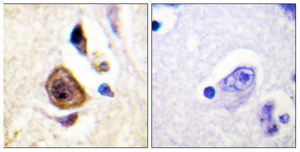 a09889 kcnc4 primary antibodies ihc testing 4