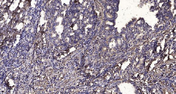 a09890 1 ncald primary antibodies ihc testing 1