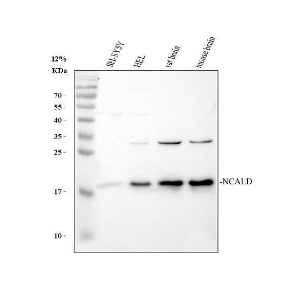 a09890 2 ncald primary antibodies wb testing 1_1