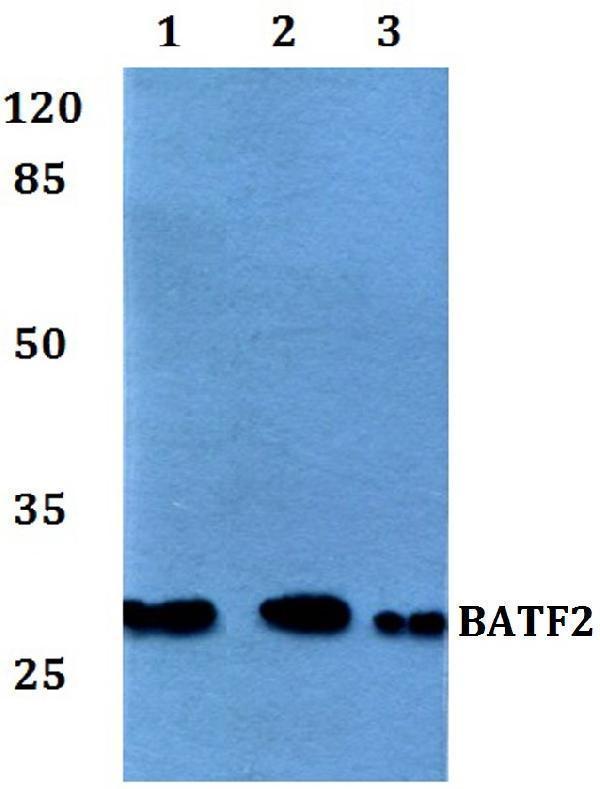 a09891 batf2 primary antiboties wb testing 1