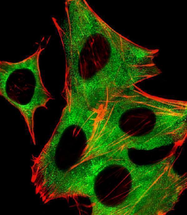 Fluorescent image of SH-SY5Y cells stained with PPP2R5B Antibody (C-term)