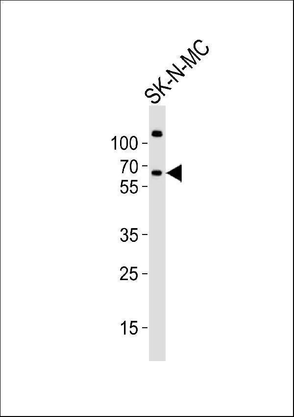 Western blot analysis of lysate from SK-N-MC cell line, using PPP2R5B Antibody (C-term) (Cat