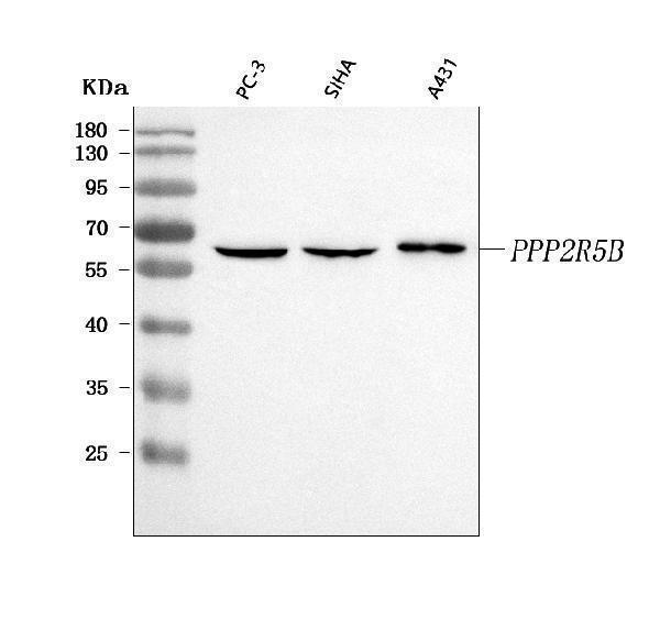  Western blot analysis of PPP2R5B using anti-PPP2R5B antibody (A09894-2)