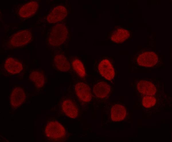 a09895 lrig2 primary antibodies if testing 2