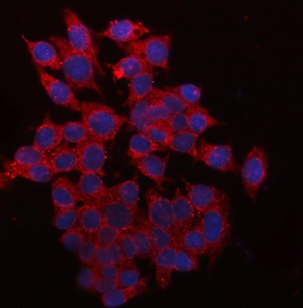  IF analysis of QPRT using anti-QPRT antibody (A09896)