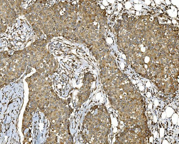 a09898 pdia5 primary antibodies ihc testing 2