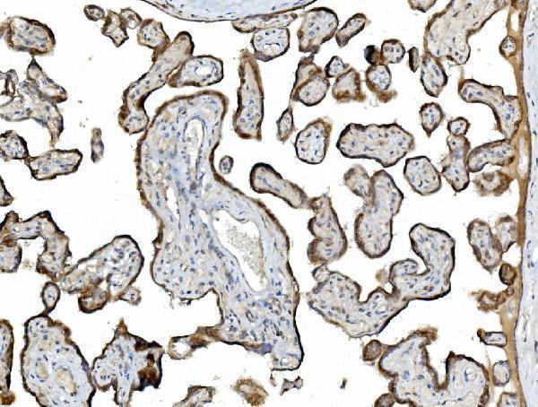 a09898 pdia5 primary antibodies ihc testing 3