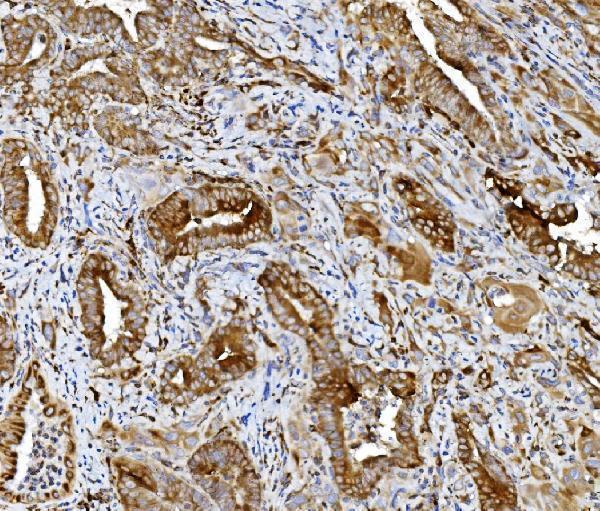 a09898 pdia5 primary antibodies ihc testing 4