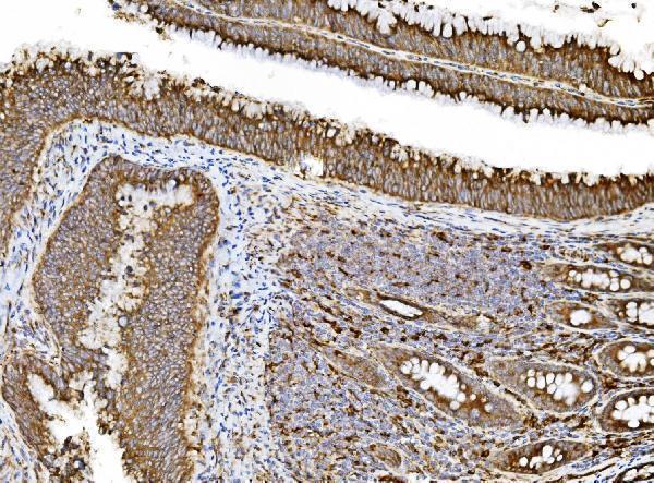 a09898 pdia5 primary antibodies ihc testing 5