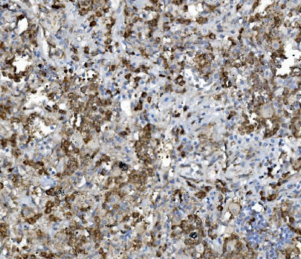 a09898 pdia5 primary antibodies ihc testing 6