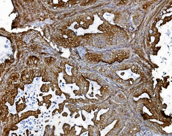 a09898 pdia5 primary antibodies ihc testing 7