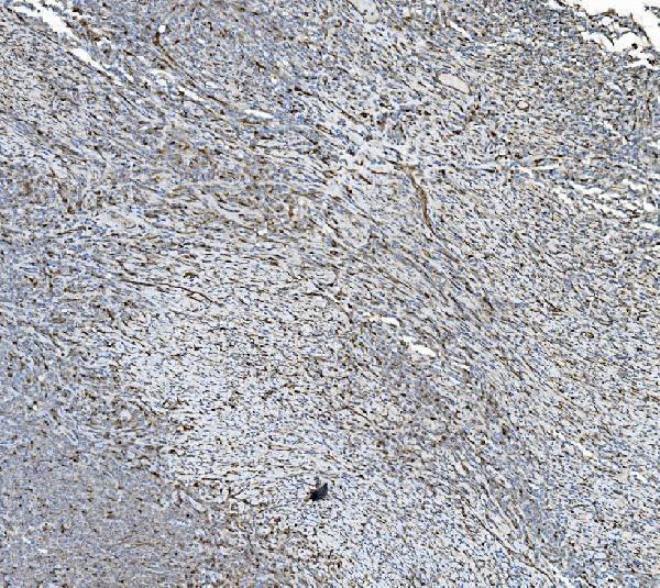 a09898 pdia5 primary antibodies ihc testing 8