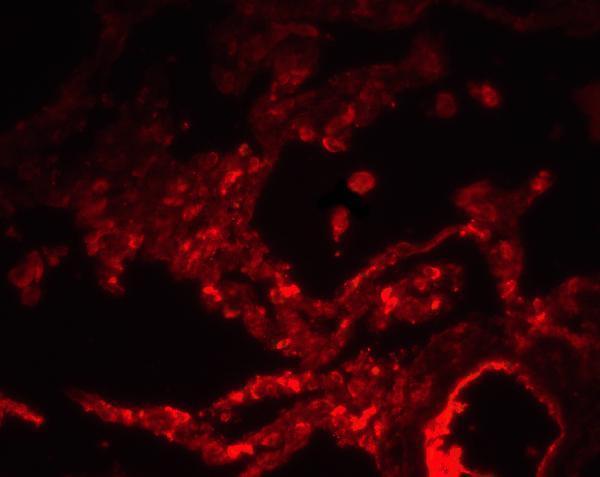 Immunofluorescence of SPINSTER in human lung tissue with SPINSTER antibody at 20 μg/ml