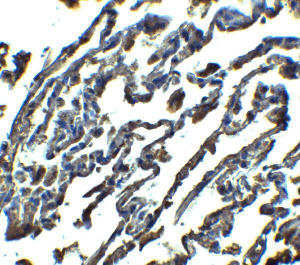Immunohistochemistry of SPINSTER in human lung tissue with SPINSTER antibody at 2