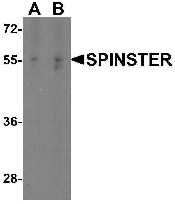 Western blot analysis of SPINSTER in HepG2 cell lysate with SPINSTER antibody at (A) 1 and (B) 2 μg/ml