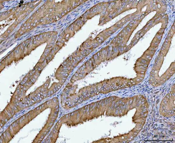  IHC analysis of SPATA18 using anti-SPATA18 antibody (A09906-1)