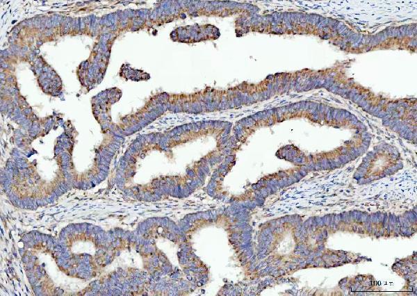  IHC analysis of SPATA18 using anti-SPATA18 antibody (A09906-1)