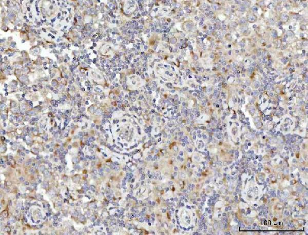 a09906 1 spata18 primary antibodies ihc testing 4