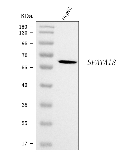  Western blot analysis of SPATA18 using anti-SPATA18 antibody (A09906-1)