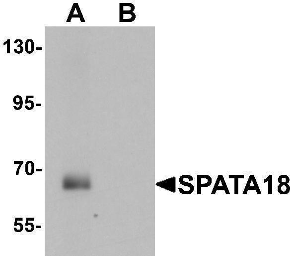 Western blot analysis of SPATA18 in rat lung tissue lysate with SPATA18 antibody at 1 μg/mL in (A) the absence and (B) the presence of blocking peptide