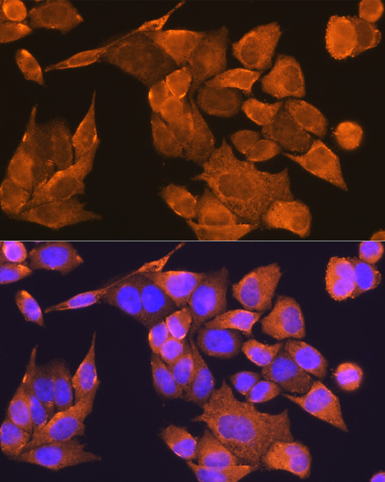 Immunofluorescence analysis of HeLa cells using PFDN5 Rabbit pAb  at dilution of 1:100 