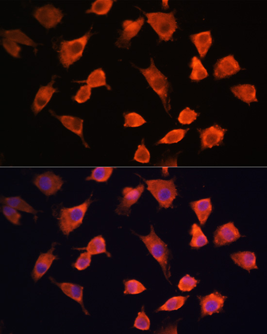 a09908 pfdn5 primary antiboties if testing 4
