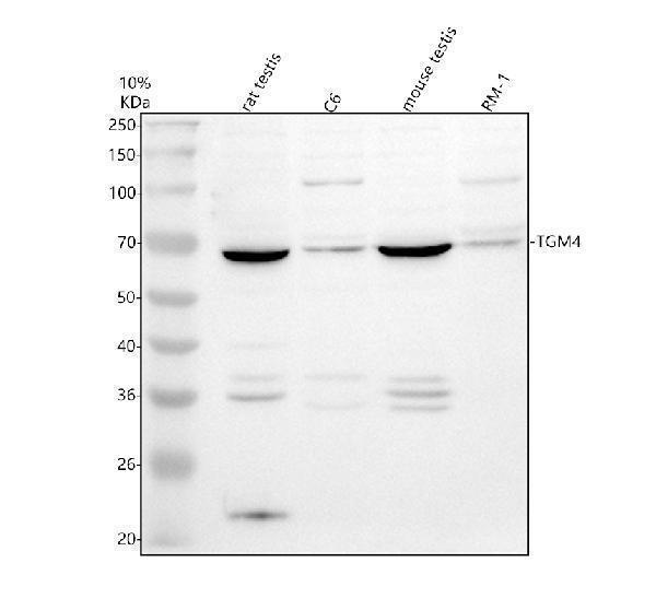 Western blot analysis of TGM4 using anti-TGM4 antibody (A09912-1)