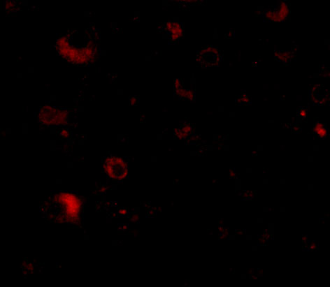 Immunofluorescence of Rim2 in Human Brain tissue with Rim2 antibody at 20 μg/mL
