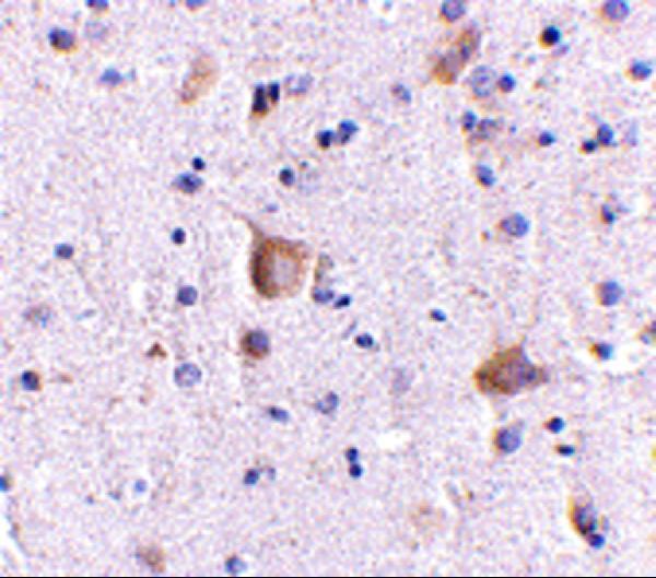 Immunohistochemistry of Rim2 in human brain with Rim2 antibody at 5 μg/mL