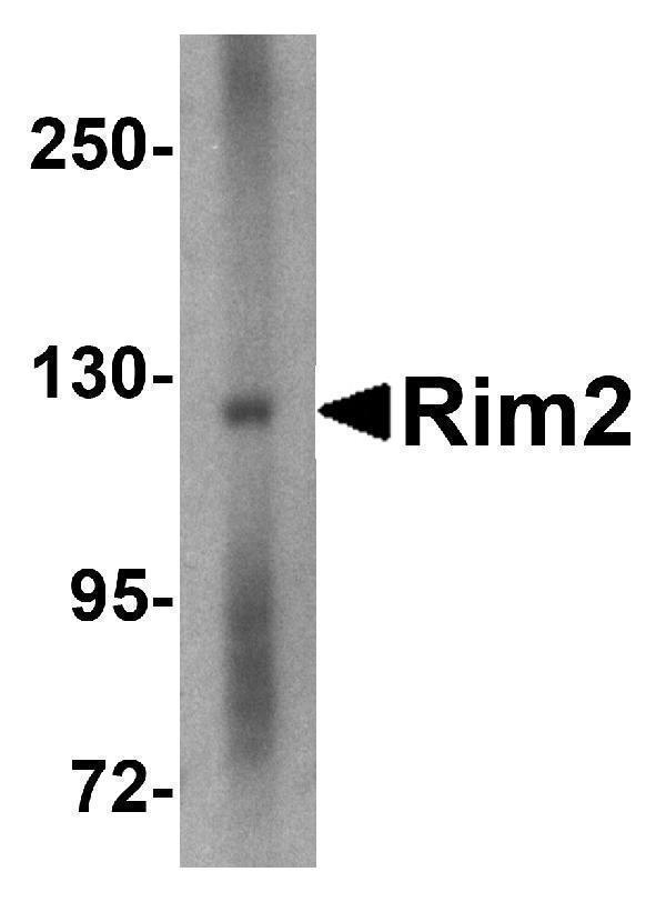 Western blot analysis of Rim2 in human brain tissue lysate with Rim2 antibody at 1 μg/mL