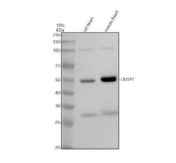 Western blot analysis of PYST2/DUSP7 using anti-PYST2/DUSP7 antibody (A09919-1)