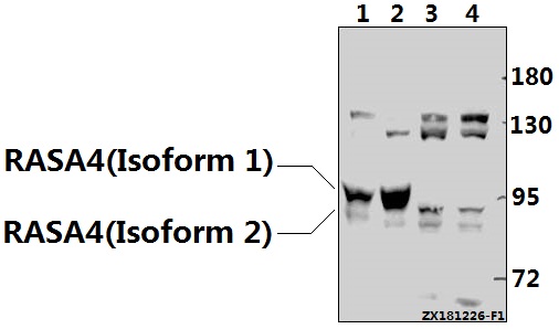 Western blot (WB) analysis of RASA4 (F157) pAb at 1:500 dilution
Lane1:3T3-L1 whole cell lysate(40ug)
Lane2:PC12 whole cell lysate(40ug)
Lane3:HEK293T whole cell lysate(40ug)
Lane4:SGC7901 whole cell lysate(40ug)