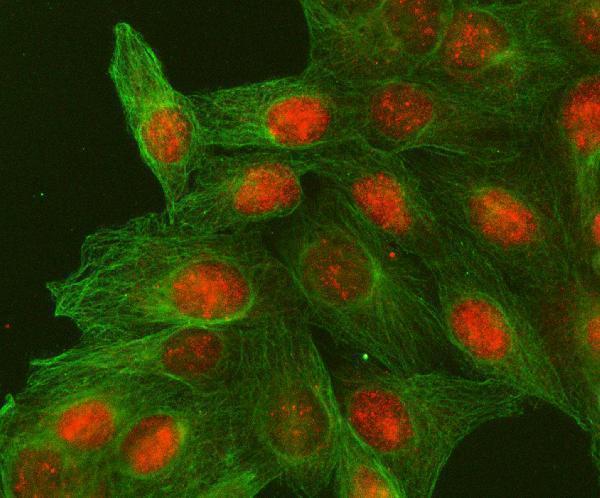 a09931 1 h2afy2 primary antibodies if testing 5