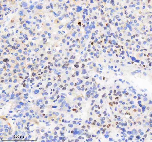 a09931 1 h2afy2 primary antibodies ihc testing 2
