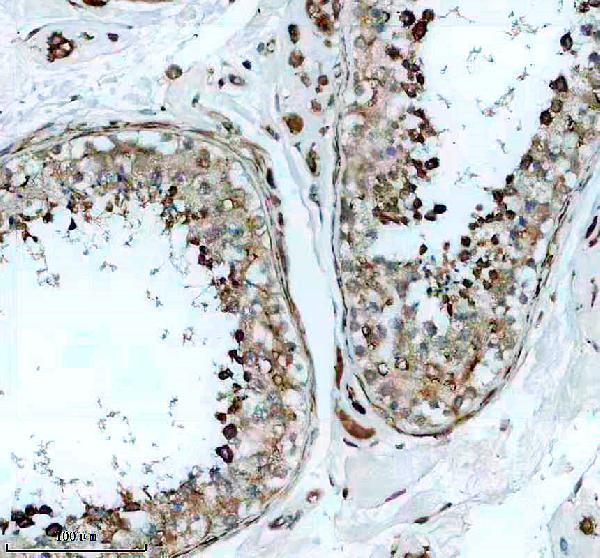 a09935 drc1 primary antibodies ihc testing 1