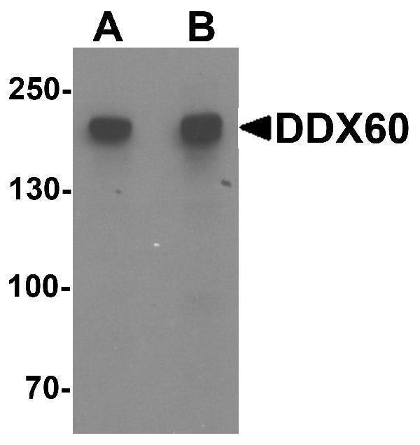 Western blot analysis of DDX60 in A20 cell lysate with DDX60 antibody at (A) 1 and (B) 2 μg/mL