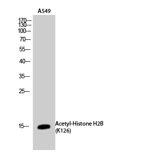 a09942 hist1h2ba primary antibodies wb testing 1