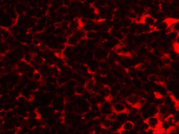 a09944 tmem38b primary antibodies if testing 3