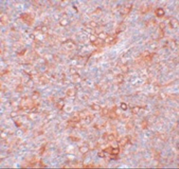 a09944 tmem38b primary antibodies ihc testing 2