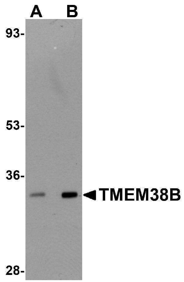 a09944 tmem38b primary antibodies wb testing 1