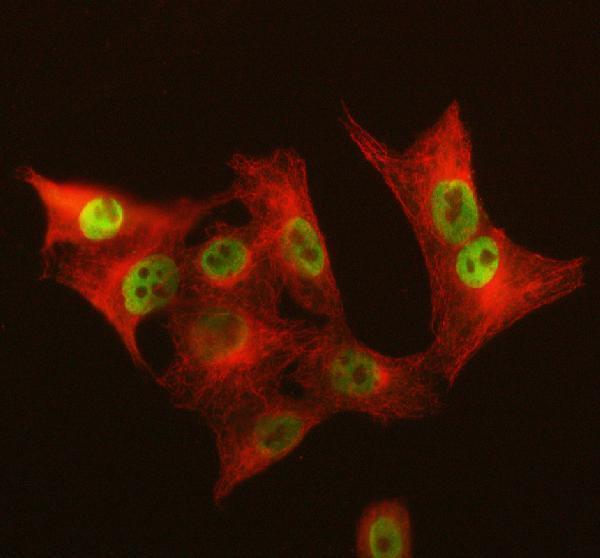 a09946 galnt12 primary antibodies if testing 2
