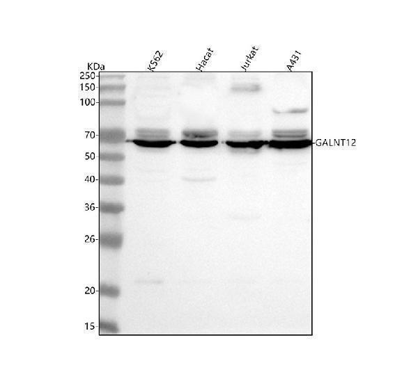 a09946 galnt12 primary antibodies wb testing 1