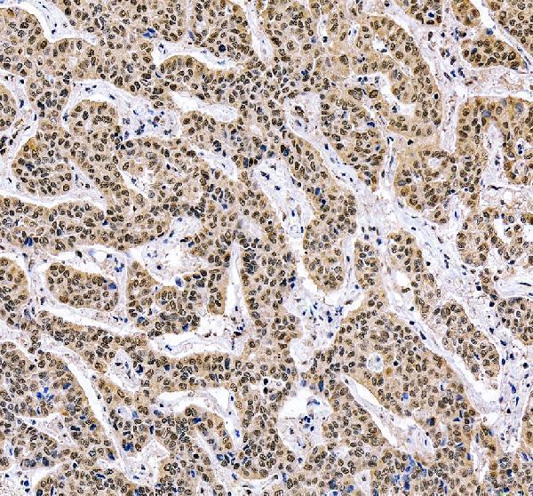 IHC analysis of RRP8 using anti-RRP8 antibody (A09950-2)