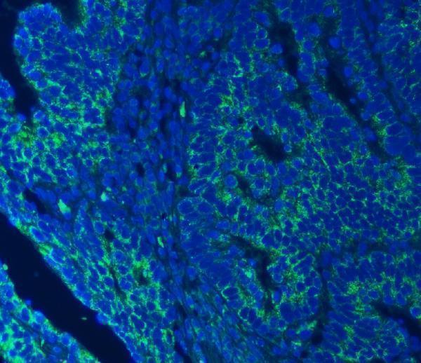 a09955 1 sec23ip primary antibodies if testing 15