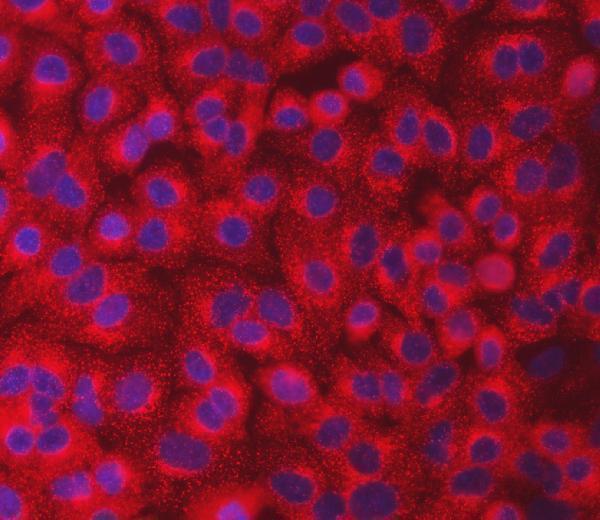 a09955 1 sec23ip primary antibodies if testing 16