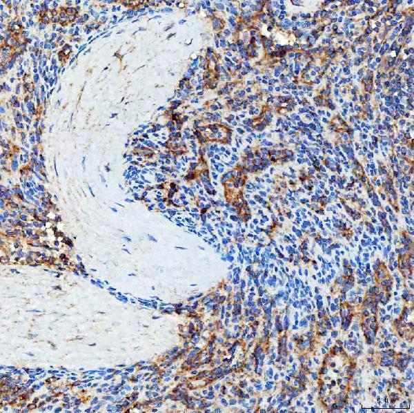 a09955 1 sec23ip primary antibodies ihc testing 11